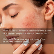 Cargar imagen en el visor de la galería, Sérum Facial Antiimperfecciones Directo – Acción Intensiva